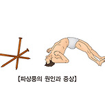 파상풍