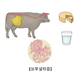 브루셀라증