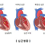 심근병증