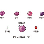 백혈병