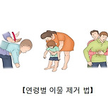 이물질에 의한 기도막힘