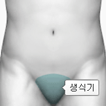 바르톨린샘의 고름집