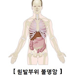 원발부위 불명암