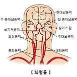 잠금증후군