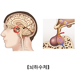 뇌하수체 기능 항진