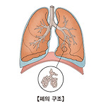 폐 전이