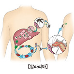 말라리아