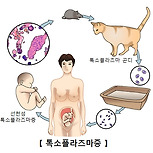 톡소플라즈마증