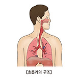 소세포성 폐암