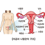 자궁 상피내 암종