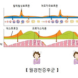 월경전 증후군