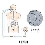 콜레라