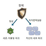 쇼그렌 증후군