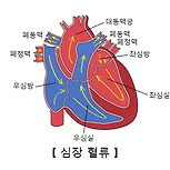 울혈성 심부전