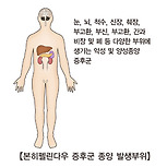 본히펠린다우 증후군