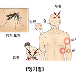 뎅기열