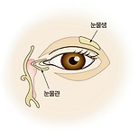 안구 건조증