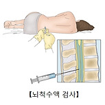 박테리아성 뇌수막염