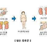 넬슨 증후군