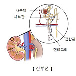 신부전