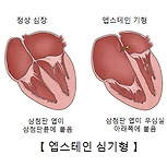 엡스테인 심기형