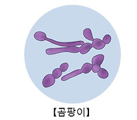 곰팡이 감염