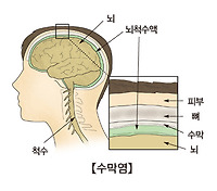 바이러스성 뇌수막염