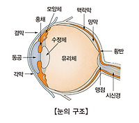 시신경염