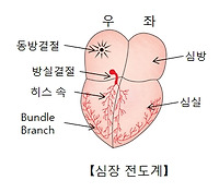 심방 세동