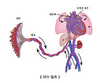 선천성 심장 질환