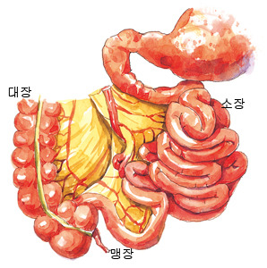 맹장