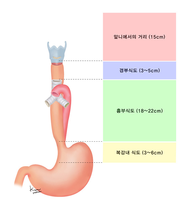 식도의 위치 - 앞니에서 거리(15cm), 경부식도(3~5cm), 흉부식도(18~22cm), 복강내 식도(3~6cm)