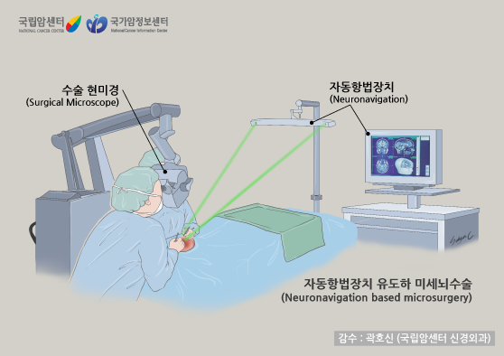 미세뇌수술