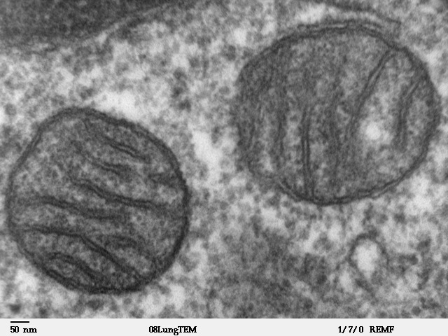 미토콘드리아(mitochondrion)