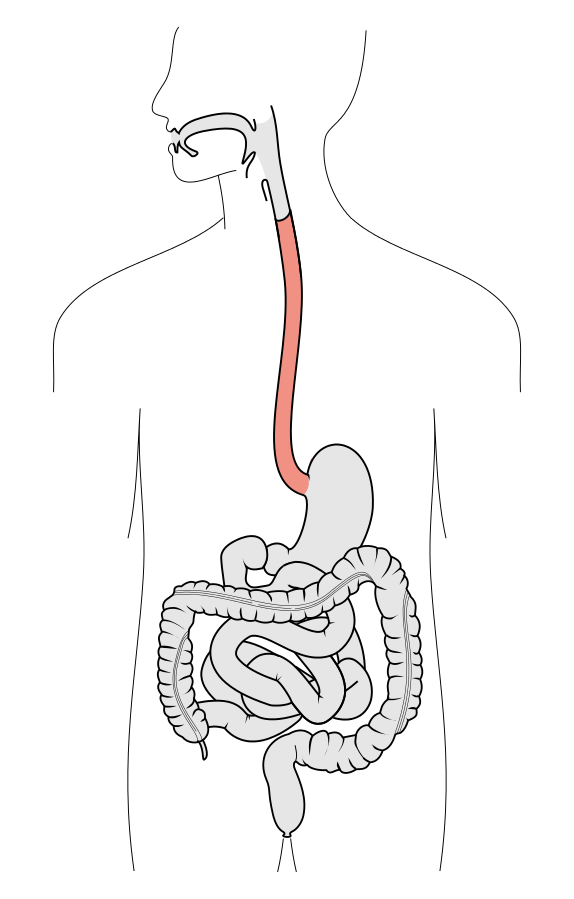 식도(esophagus)