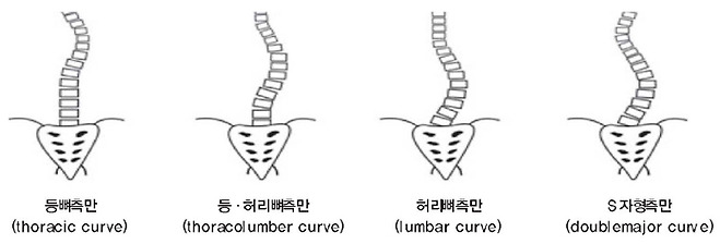 등뼈와 허리뼈 측만