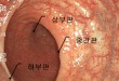 직장 휴스톤판의 내시경적 소견 - 하부판, 상부판, 중간판