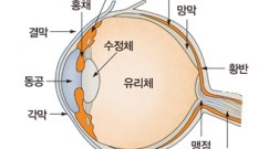 눈의 피로