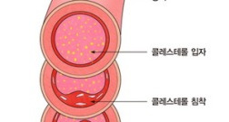 콜레스테롤