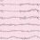 심부정맥(cardiac arrhythmia)