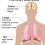 폐결핵(pulmonary tuberculosis)