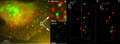 Breast Cancer Cells: 3D Dual Color Super Resolution Microscopy of Her2 and Her3 & cluster calculations