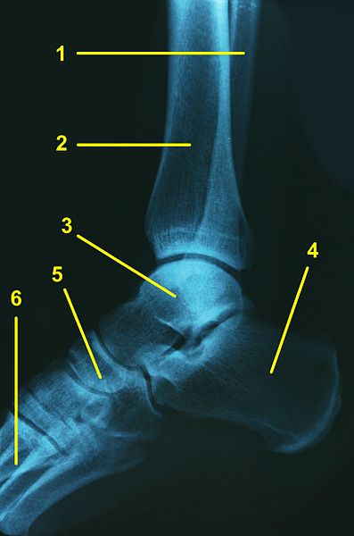 File:Ankle1.jpg