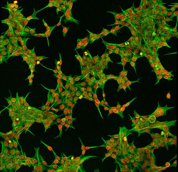 Immunofluorescent Human Embryonic Kidney 293 cells