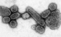 Spanish Flu Virus